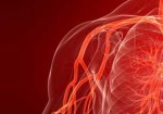angiologia-maranguape-1377266589