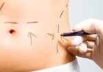 cirurgia-plastica-maranguape-1377198904