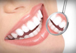 planos-odontologicos-maranguape-1377280679