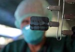 radiografia-odontologia-maranguape-1377282317